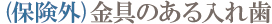 (保険外)金具のある入れ歯 (保険外)金具のある入れ歯