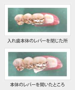リーゲルレバー リーゲルレバー