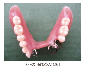 下の保険の入れ歯 下の保険の入れ歯