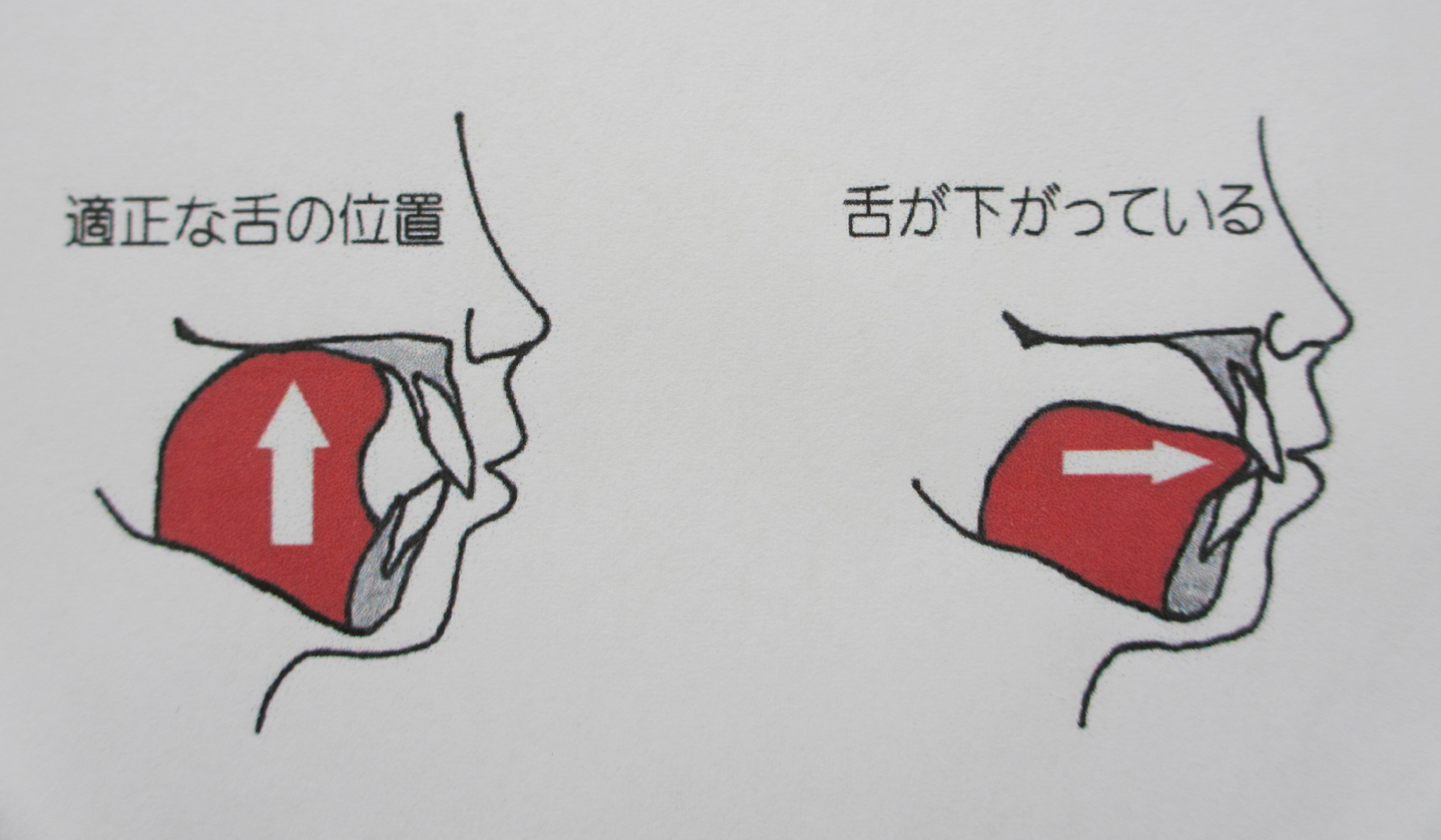 正しい舌の位置 正しい舌の位置