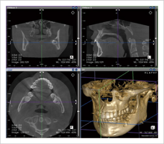 CT�B�e