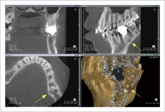 CT�B�e