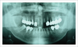 CT�B�e