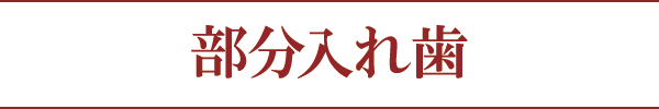 部分入れ歯 部分入れ歯