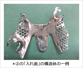 の「入れ歯」の構造体の一例 の「入れ歯」の構造体の一例