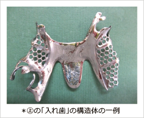 ��の「入れ歯」の構造体の一例