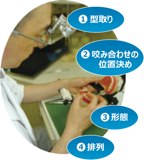 入れ歯作りの難しさ 入れ歯作りの難しさ