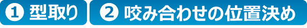 @型取りA咬み合わせの位置決め @型取りA咬み合わせの位置決め
