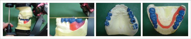 診断用WAXUP作業 診断用WAXUP作業
